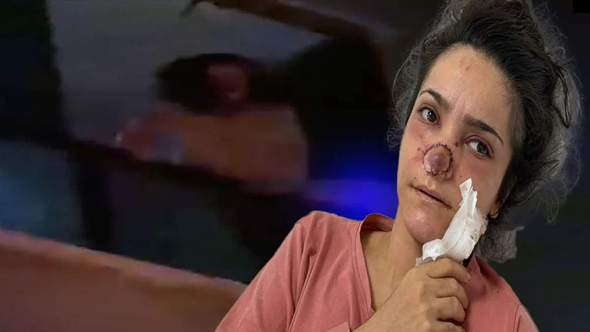 Manisa'da cani koca dehşeti! Tartıştığı eşinin burnunu koparmıştı: "Canımın acısıyla balkondan atlayacaktım!"