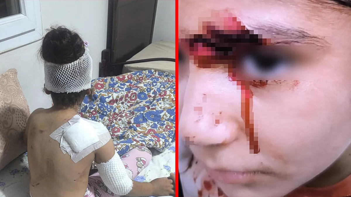 Şanlıurfa'da başıboş köpek dehşeti! 8 yaşındaki çocuğa saldırdılar: 150 dikiş atıldı!